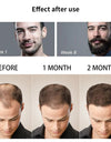 Beard Growth Oil Activator Serum Balm for Facial Hair Regrowth and Thickness for Bearded Men 100% Organic Beard Growth Serum